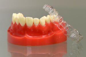 SmileFlex Single Arch