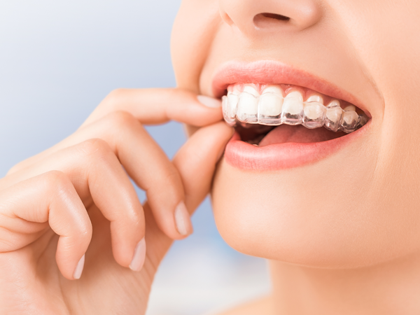 Additional Retainers